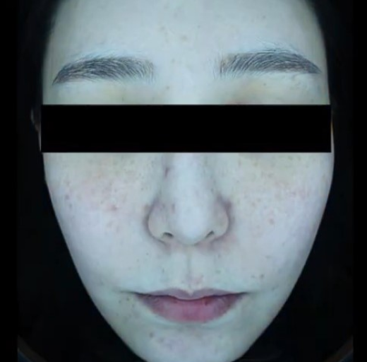 Before/After Image